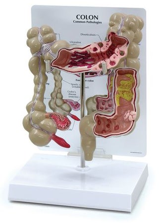 Colon Model Nasco