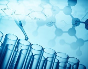 General Chemistry Reagent TIBC / UIBC For Clinical Chemistry Analyzers