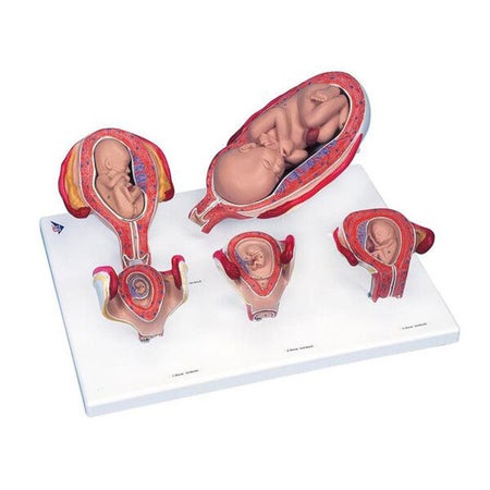 Pregnancy Model 3B Scientific® 4.63 lbs.