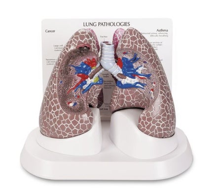 Lung Model Galloway Plastics Cancer