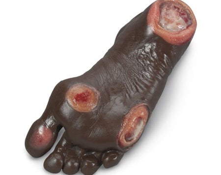 Pressure Ulcer Foot Model Life/form®