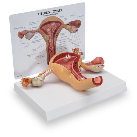 Uterus Model Galloway Plastics Full-Size 2 lbs.