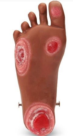 Foot Model Life/form® GERi™ and KERi™ Optional Pressure Injury Foot 2-1/2 lbs.