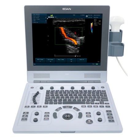 Ultrasound System