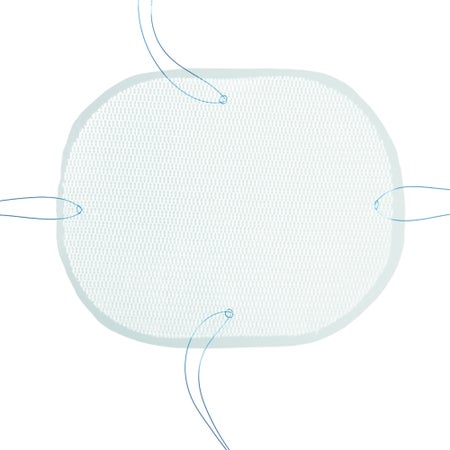 Ventral Hernia Repair Mesh Parietex™ Partially Absorbable Polyester, Collagen Film 9 cm Diameter Circle Intraperitoneal Style White Sterile