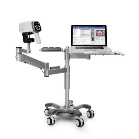 Colposcope with Arm Swing Edan