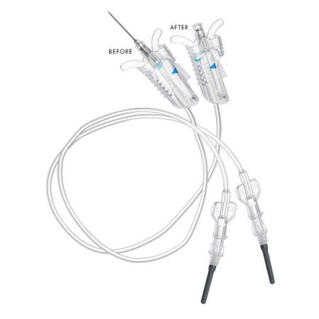 VanishPoint® Blood Collection Set 23 Gauge 3/4 Inch Needle Length Safety Needle 12 Inch Tubing Sterile