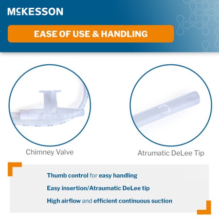 Suction Catheter Tray McKesson 12 Fr. DeLee Tip Chimney Control Vent
