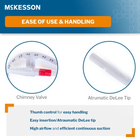 Suction Catheter Tray McKesson 18 Fr. DeLee Tip Chimney Control Vent