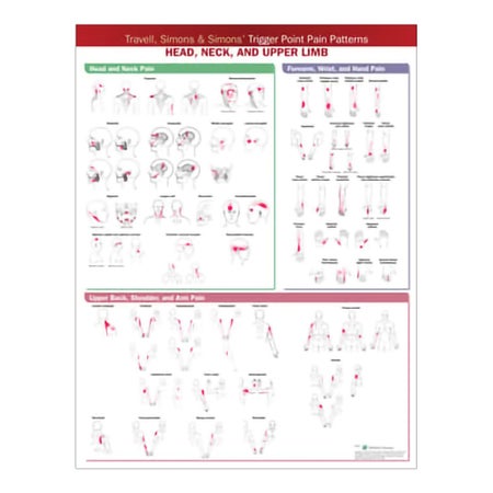 Anatomical Chart Wolters Kluwer Trigger Point Pain Patterns: Head, Neck, and Upper Limb 2nd Edition 20 X 26 Inch Paper Wall Mount Laminated