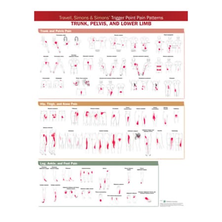 Anatomical Chart Wolters Kluwer Trigger Point Pain Patterns: Trunk, Plevis, and Lower Limb 2nd Edition 20 X 26 Inch Paper Wall Mount Laminated
