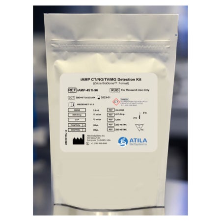 Molecular Reagent iAMP® CT / NG / TV / MG Detection Kit For Research Use Only For Real Time PCR System with FAM / HEX / ROX / CY5 / CYC 5.5 Fluorescence Channels 96 Tests