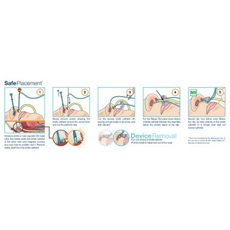 Pediatric Nasal Bridle Kit AMT Bridle Pro® White, 8 Fr. For Nasoenteric Feeding Tube