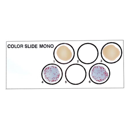 Other Infectious Disease Test Kit Color Slide® II Infectious Mononucleosis 24 Tests CLIA Non-Waived