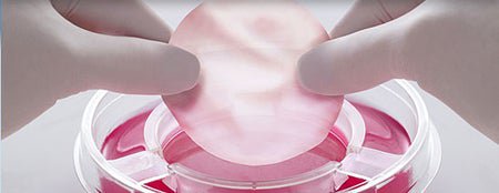 Skin Graft Therapy Apligraf® Round Viable human cells, cultured in vitro