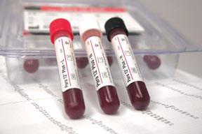 Hematology Control Para 12® Plus 12 X 3 mL