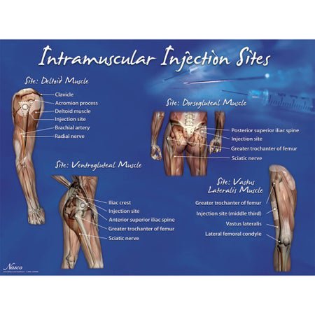 Educational Poster Intramuscular Injection Sites Training Poster 18 X 24 Inch Heavy Paper Grommets Laminated
