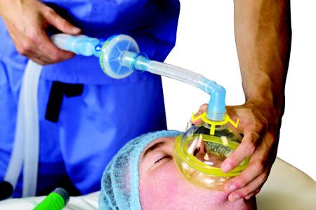 Flexicare® Anesthesia Breathing Circuit Expandable Tube 108 Inch Tube Dual Limb Pediatric 2 Liter Bag Single Patient Use Jackson-Rees Circuit