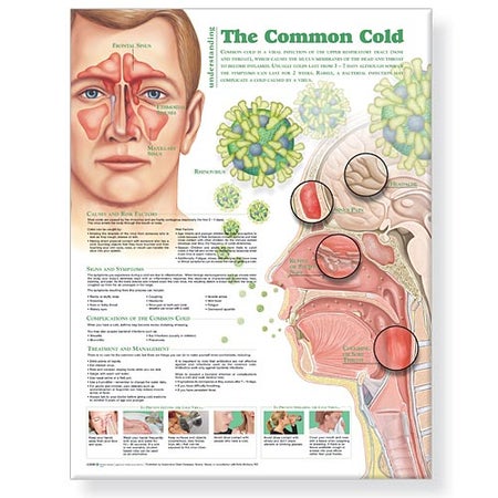 Anatomical Chart Understanding the Common Cold 20 X 26 Inch Heavy Paper Laminated