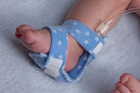 IV Armboard Dale® Bendable Armboard 4-1/4 X 1 Inch Infant Flexible