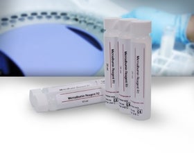 General Chemistry Reagent Pointe™ Microalbumin For Clinical Chemistry Analyzers 200 Tests