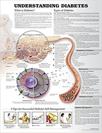 Anatomical Chart Understanding Diabetes 20 X 26 Inch Heavy Paper Grommets Laminated