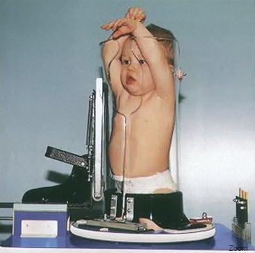 X-Ray Immobilizer/Positioner Pigg-O-Stat™ Pediatric, 20 X 22 X 35 Inch, With Standard Film Cassette Holder