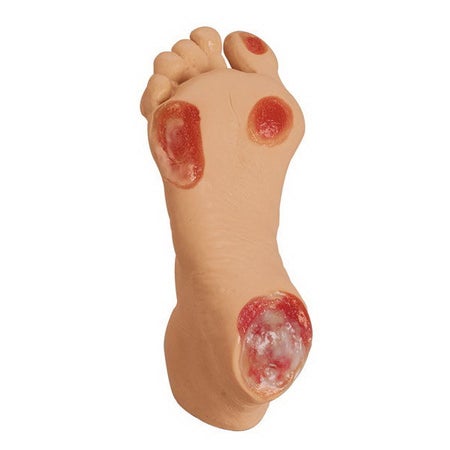 Pressure Ulcer Foot Model Life/form® Adult - Geriatric 2-1/5 lbs.