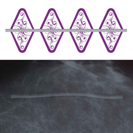Radiology Skin Marker Spee-D-Line™ Swirl Collection™ Line Scar