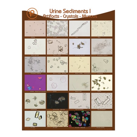 Urine Sediments Charts Artifacts, Crystals, Mucous 18 W X 24 H Inch Wall Mount