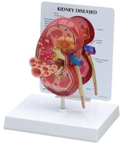 Kidney Model GPI Anatomicals
