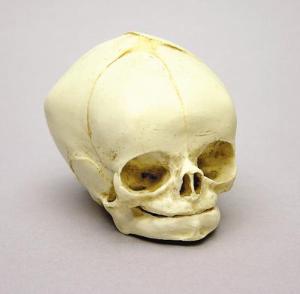 Skull Model Bone Clones Fetal Skull