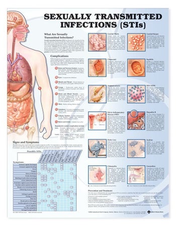 Anatomical Chart Sexually Transmitted Infections (STIS) 20 X 26 Inch Heavy Paper Grommets Laminated