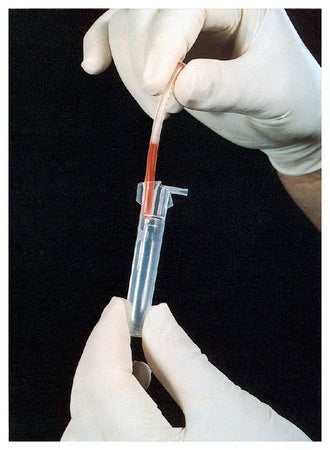 Segment Processor Alpha Scientific SEG·SAFE™
