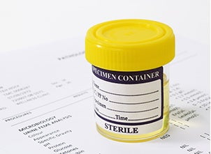 General Chemistry Reagent Alanine Aminotransferase (ALT) For Mindray BS-480 Analyzer