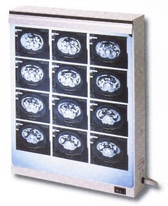 X-Ray Illuminator Econoline 1 Bank 1 Tier 2 Lamp 15 W Wall Mount 18-1/4 W X 14 H X 3-1/2 D Inch One, 17 L X 14 W Inch Film