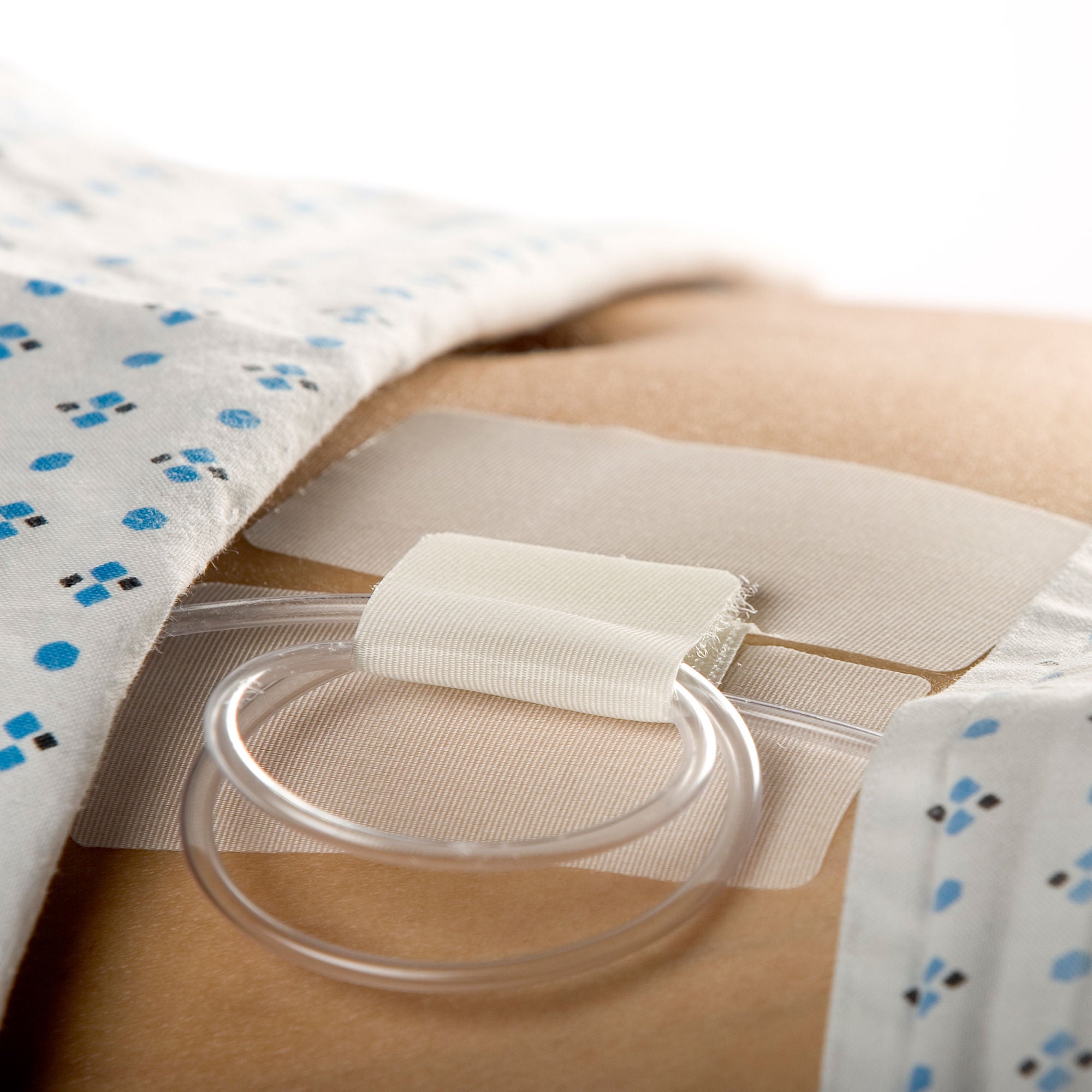 Cath-Secure Holder, Tube MK 192067